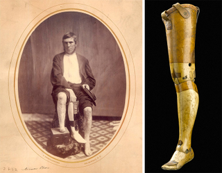 Illustration for article titled The Fascinating Untold History of War and Prosthetics